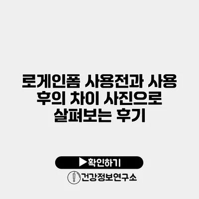 로게인폼 사용전과 사용 후의 차이 사진으로 살펴보는 후기