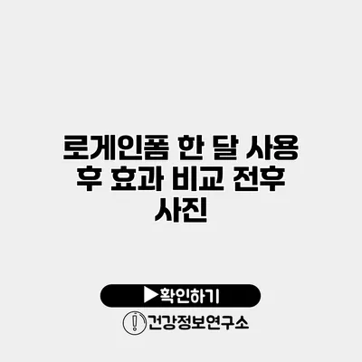 로게인폼 한 달 사용 후 효과 비교 전후 사진
